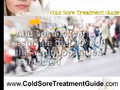 Cold Sore Treatment