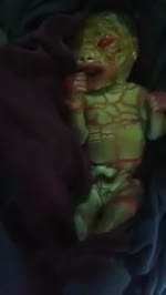 It's Reptilian Baby! Not a Harlequin ichthyosis, sheeple
