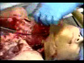 Female Autopsy Part 1