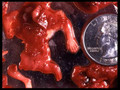 Abortions Kill Inocent Children -Warning-