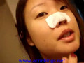 Pull out my blackheads @ www.acneblogs.net