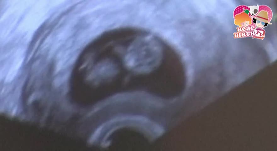 Week 9 - first ultrasound