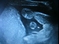 Babygram 15