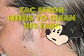Zac Efron's Disgusting, Filthy Ears