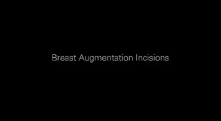 Hiding Scars During Breast Augmentation Fairfax VA