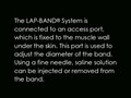 Lap Band Procedure