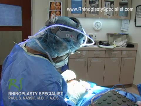 Ethnic Rhinoplasty Nose Surgery : Open Rhinoplasty