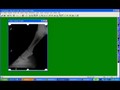 Introduction to Digital X-rays Douglas Novick DVM