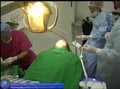 INTRALIFT Live Surgery with simultaneous insertion of implants