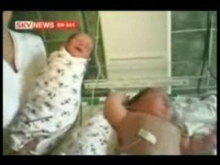 !!WOMEN GIVES BIRTH TO A 15 POUND(6.8KG) BABY IN ROMANIA!!