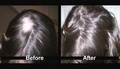 Hannah Farrow talks about her experience with hair loss for managinghairloss.com
