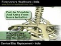 Spine surgery costs in India gets reduced by 55% 