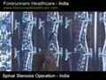 Spinal stenosis surgery available in India with or without fusion