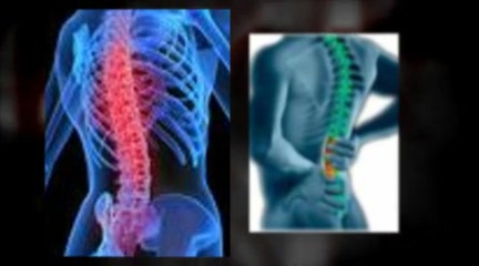 Raleigh: Don't Let Your Back Pain Run Your Life.