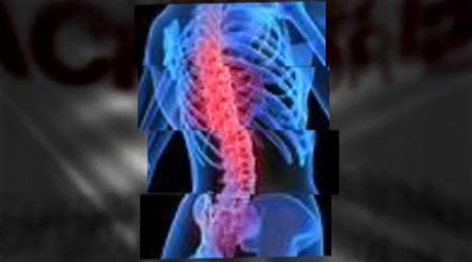 Raleigh: Would You Like To Avoid Spinal Surgery?