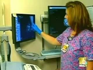 Breast Cancer Risk Screening