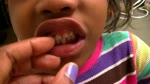 How to lose a tooth with Jakira Frazier (Jamarcus NewtonCousin)