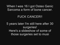 Fuck Cancer!