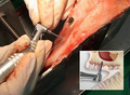 INTRALIFT - live demonstration of the surgical protocol on a sheep head