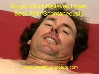 Acupuncture Provides Spontaneous Relief From Lower Back Pain