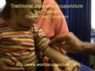 Infant Acupuncture for Chest Congestion.wmv
