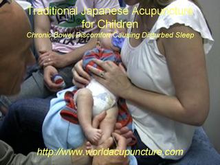 Infant Acupuncture for colicy wind pain.wmv