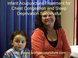 Infant Acupuncture Aids Chest Congestion 