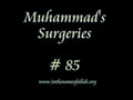 85 Muhammad's Surgeries