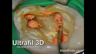 Watch Videos Online | ULTRAFIL 3D | Veoh.com